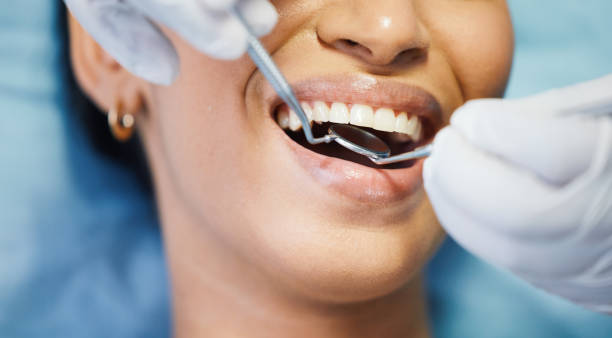 Best Dentist for Tooth Abscess  in St Charles, MI
